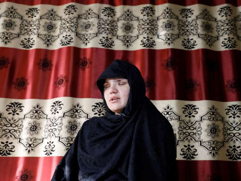 চাকরি করায় ছুরিকাঘাত, চোখ হারালেন আফগান নারী পুলিশ