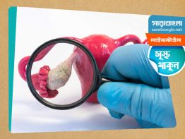 ডিম্বাশয়ের ক্যান্সারের ৯টি লক্ষণ, একটু মিলিয়ে দেখুন তো