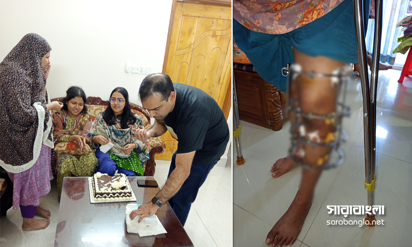 ‘গুলিবিদ্ধ ২ মেয়ের পা কেটে ফেলতে বলেছিলেন শেখ হাসিনা’