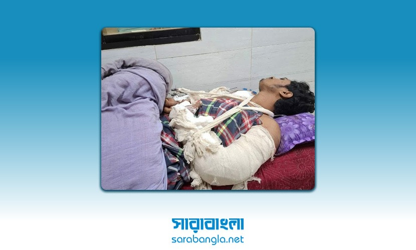খুঁটির সঙ্গে বেঁধে যুবককে কুপিয়ে জখম, গ্রেফতার ২