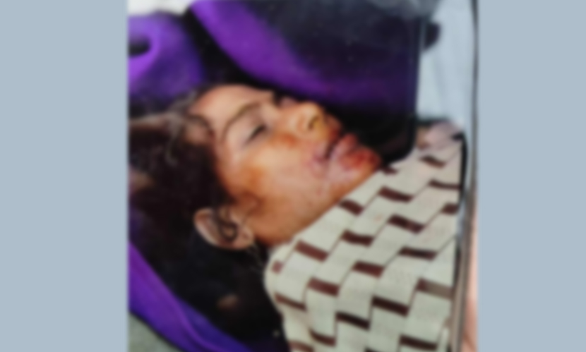 খুলনায় প্রাইভেটকারের ধাক্কায় নারী নিহত