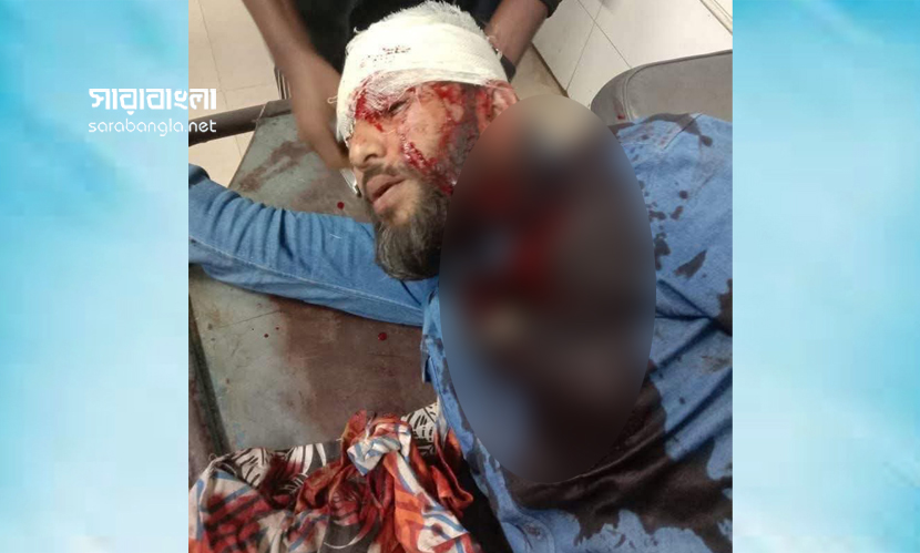 এনসিপির খুলনা বিভাগীয় প্রধান মোতালেব গুলিবিদ্ধ