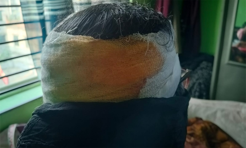 কদমতলীতে জামায়াতের নির্বাচনি প্রচারে দলের নারী নেত্রীকে কোপাল দুর্বৃত্তরা