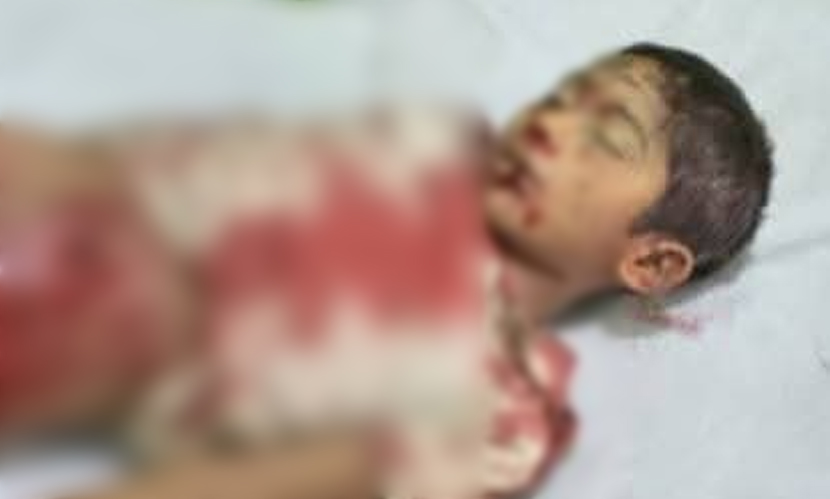 কক্সবাজারে এমপি আলমগীর ফরিদের গাড়িবহরের ধাক্কায় শিশু নিহত