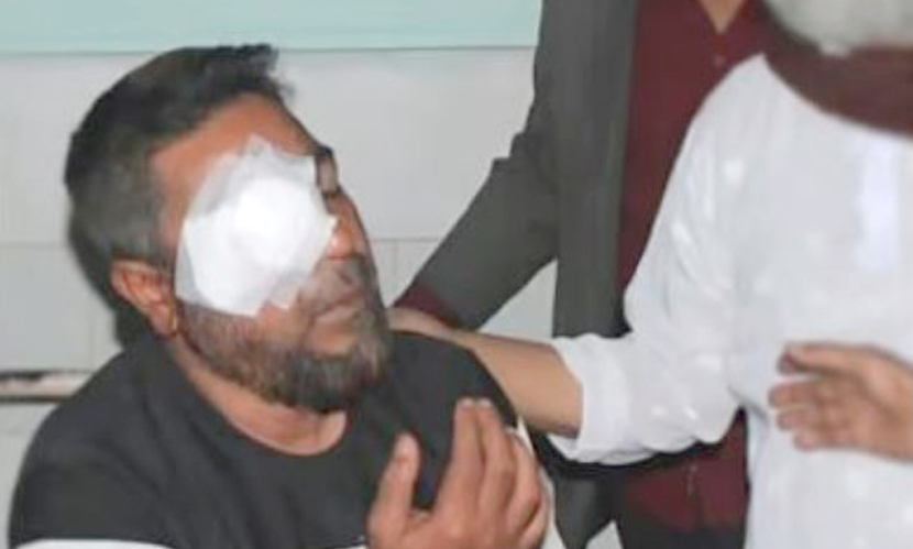 জামায়াতের সঙ্গে সংঘর্ষে বিএনপি নেতার চোখ জখম, খবর শুনে মায়ের মৃত্যু