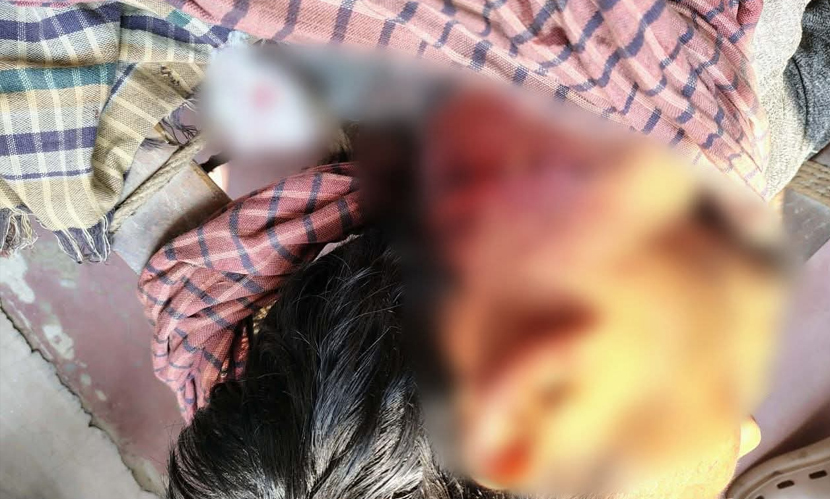 চাঁপাইনবাবগঞ্জে ধূমপান নিয়ে কথা কাটাকাটি, যুবককে কুপিয়ে জখম