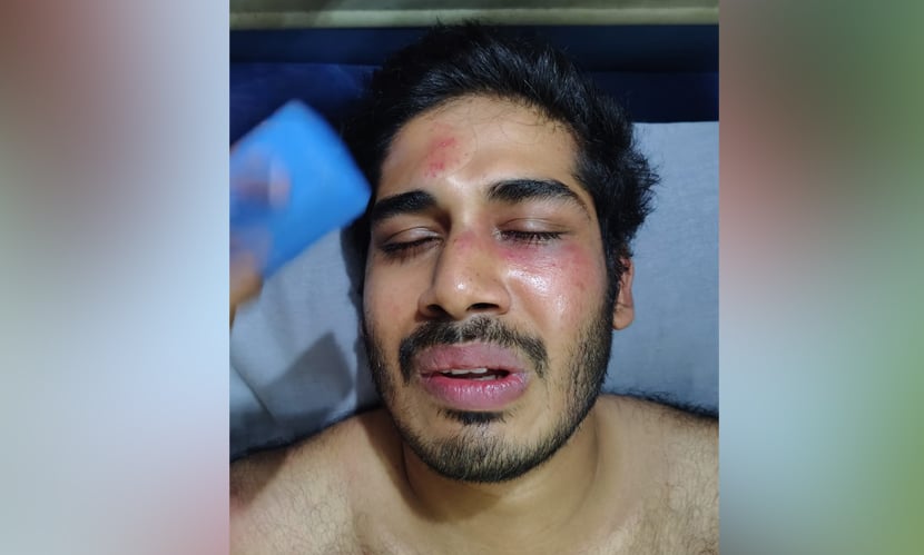 অতিরিক্ত ভাড়া নেওয়ায় প্রতিবাদ, চবি শিক্ষার্থীকে মারধর