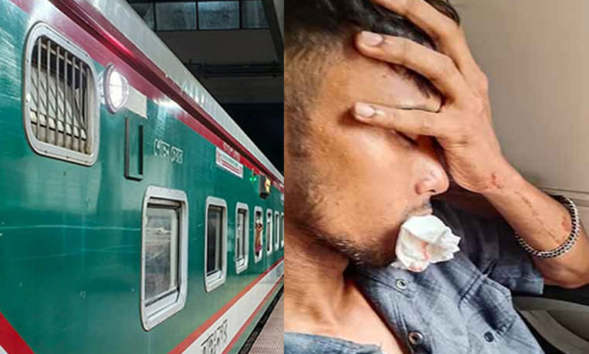 চলন্ত ট্রেনে পাথর নিক্ষেপ, ভাঙল যাত্রীর ৪ দাঁত