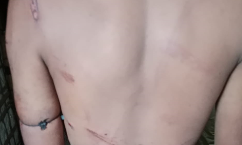 মুক্তিপণে ফিরলেন অপহৃত রোহিঙ্গা যুবক