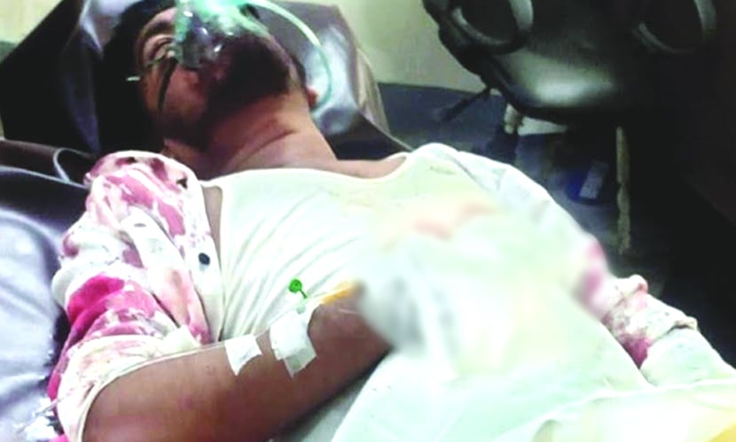 চট্টগ্রামে যুবদলকর্মীর হাতের কব্জি বিচ্ছিন্ন করল প্রতিপক্ষ