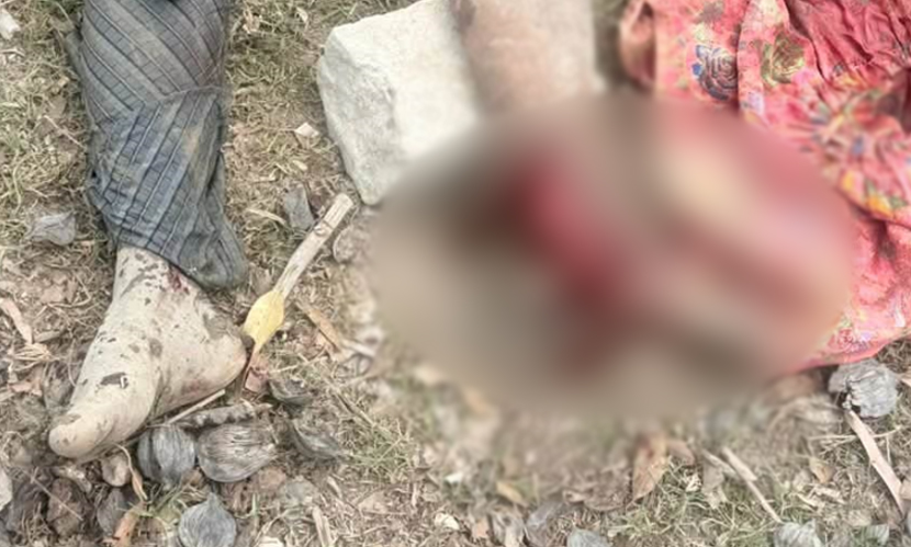 মাছ ধরতে গিয়ে মাইন বিস্ফোরণে উড়ে গেল রোহিঙ্গা যুবকের পা