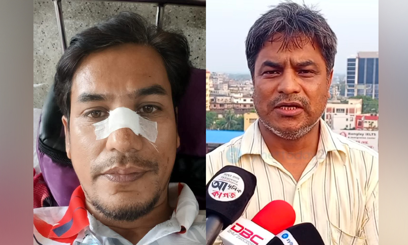 সিলেটে একদিনে ছিনতাইয়ের শিকার ২ সাংবাদিক