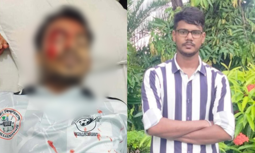 কুবি শিক্ষার্থীকে মেরে রক্তাক্ত, অভিযুক্তকে স্থায়ী বহিষ্কারের দাবি