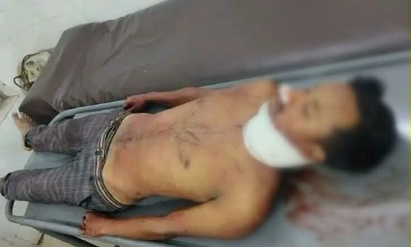 গাইবান্ধায় স্কুল কমিটি নিয়ে দ্বন্দ্ব, শিবির নেতাকে গলাকেটে হত্যা