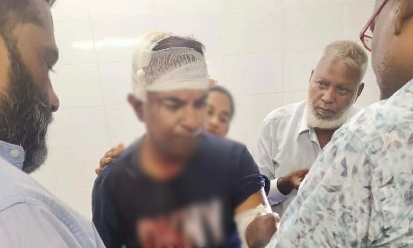 ফরিদপুরে দুর্বৃত্তের হামলায় বিএনপি নেতাসহ আহত ২