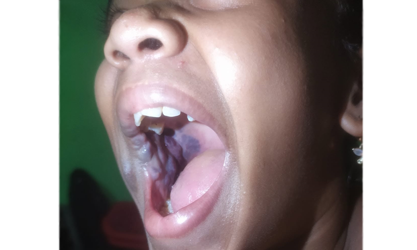 শিশু শাবানার চিকিৎসায় পাশে দাঁড়াই